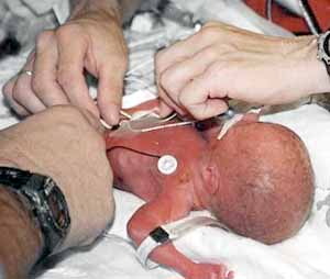 Premature-Birth-Rate