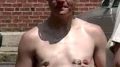 transgender_breasts_removed_boston